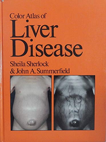 Beispielbild fr Color atlas of liver disease zum Verkauf von Wonder Book