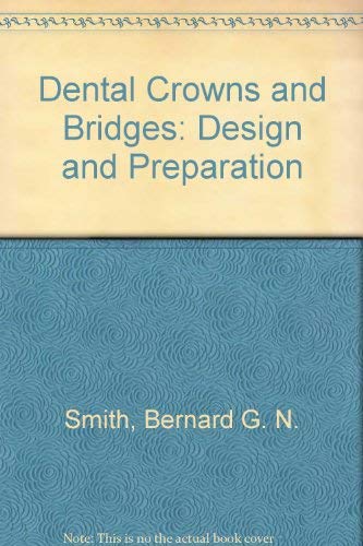 9780815178071: Dental Crowns and Bridges: Design and Preparation