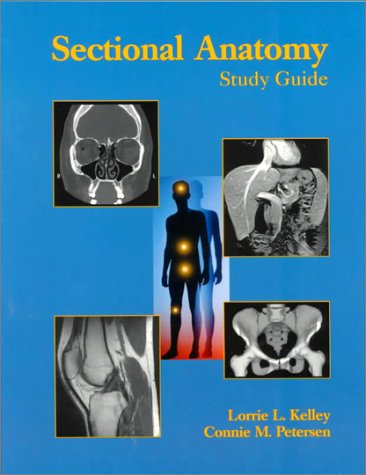 Stock image for Sectional Anatomy Study Guide for sale by ThriftBooks-Atlanta