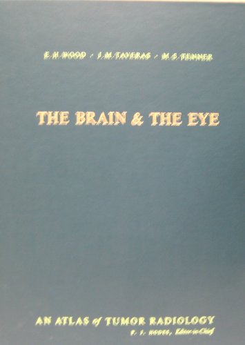 Beispielbild fr Atlas of Tumor Radiology - The Brain and the Eye zum Verkauf von UHR Books