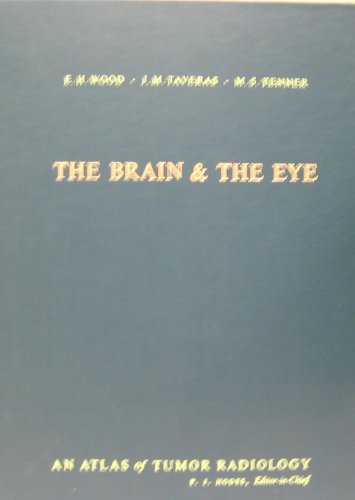 9780815187295: Brain and the Eye (Atlas of Tumour Radiology)