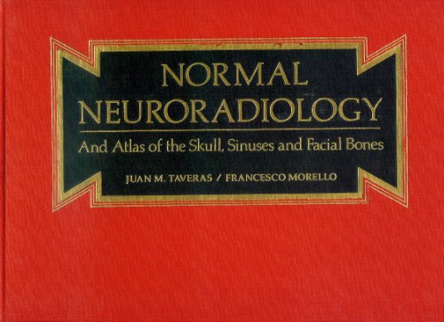 Imagen de archivo de Normal neuroradiology: And atlas of the skull, sinuses ; and facial bones a la venta por dsmbooks