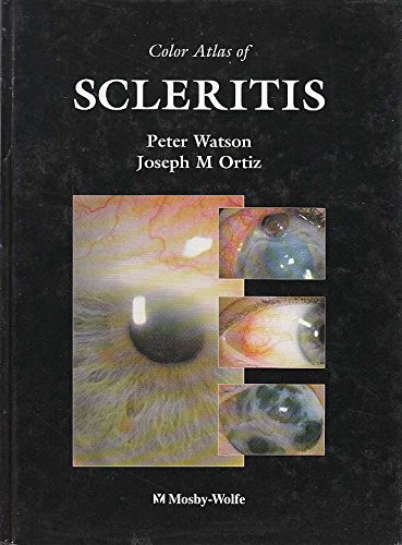 Stock image for Color Atlas Of Scleritis for sale by Mispah books