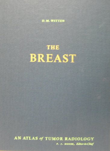 Imagen de archivo de The Breast a la venta por Mt. Baker Books