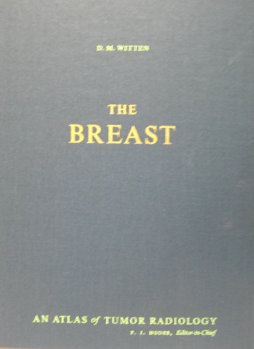 Stock image for The Breast for sale by Mt. Baker Books