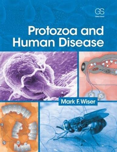 9780815365006: Protozoa and Human Disease