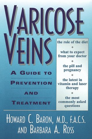 Imagen de archivo de Varicose Veins: A Guide to Prevention and Treatment a la venta por HPB-Movies