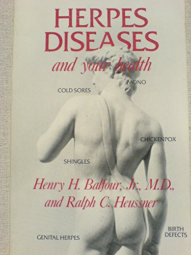 Imagen de archivo de Herpes Diseases and Your Health a la venta por HPB-Ruby