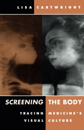 Imagen de archivo de Screening The Body: Tracing Medicine  s Visual Culture a la venta por WorldofBooks