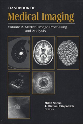 Beispielbild fr Handbook of Medical Imaging zum Verkauf von Ammareal