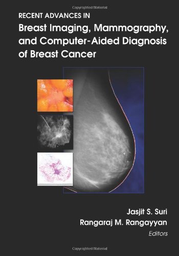 Imagen de archivo de Recent Advances in Breast Imaging, Mammography, and Computer-Aided Diagnosis of Breast Cancer (SPIE Press Monograph Vol. PM155) a la venta por Revaluation Books