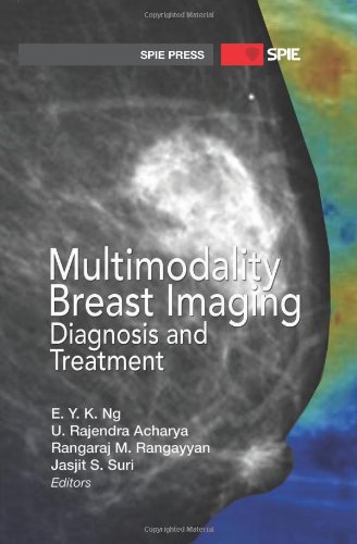 Imagen de archivo de Multimodality Breast Imaging: Diagnosis and Treatment (SPIE Press Monograph PM227) [Hardcover ] a la venta por booksXpress