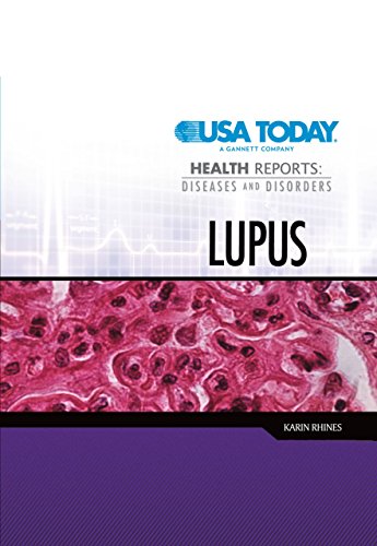 9780822585824: Lupus