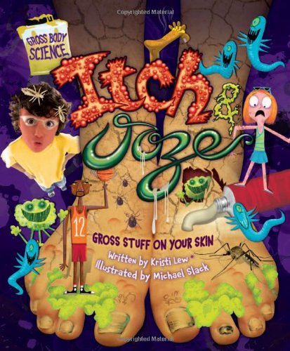 Stock image for Itch Ooze: Gross Stuff on Your Skin (Gross Body Science) for sale by Off The Shelf