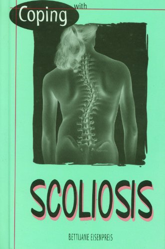 9780823925575: Coping with Scoliosis