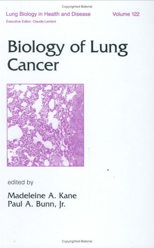 9780824701321: Biology of Lung Cancer: 122 (Lung Biology in Health and Disease)
