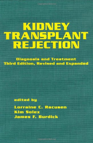 Stock image for Kidney Transplant Rejection: Diagnosis and Treatment, Third Edition for sale by Solr Books