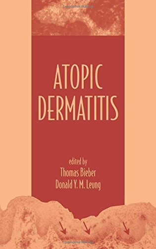 Stock image for Atopic Dermatitis for sale by medimops