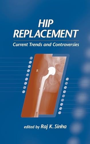 9780824707897: Hip Replacement: Current Trends and Controversies