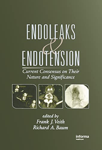 Stock image for Endoleaks and Endotension: Current Consensus on Their Nature and Significance for sale by HPB-Red
