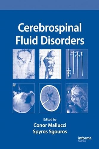 Beispielbild fr Cerebrospinal Fluid Disorders Mallucci, Conor and Sgouros, Spyros zum Verkauf von online-buch-de