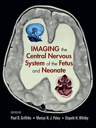 Stock image for Imaging the Central Nervous System of the Fetus and Neonate for sale by Books Puddle