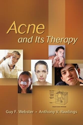 9780824729714: Acne and Its Therapy (Basic and Clinical Dermatology)