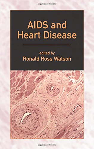 9780824741150: AIDS and Heart Disease (No Series)