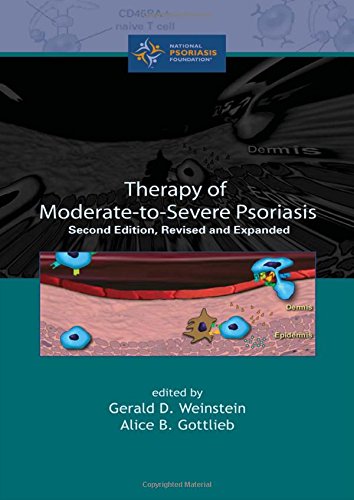 Imagen de archivo de Therapy of Moderate-to-Sever Psoriasis a la venta por Better World Books