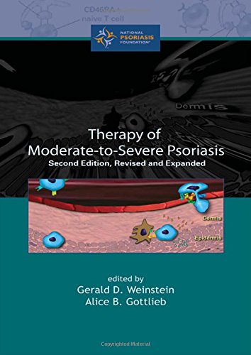 Stock image for Therapy of Moderate-To-Severe-Psoriasis, Second Edition for sale by ThriftBooks-Atlanta