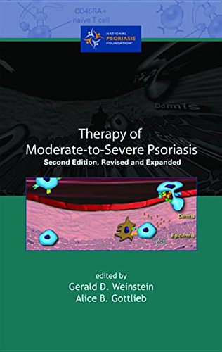 9780824748173: Therapy of Moderate-to-Severe-Psoriasis