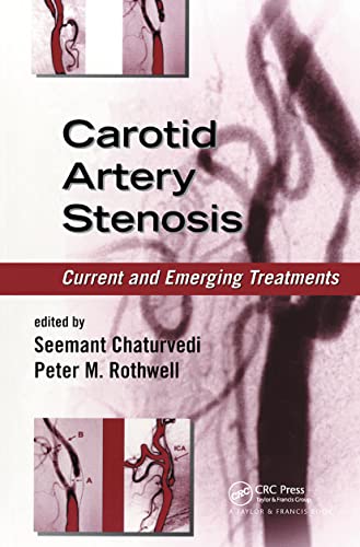 Stock image for Carotid Artery Stenosis: Current and Emerging Treatments (Neurological Disease and Therapy) for sale by Chiron Media