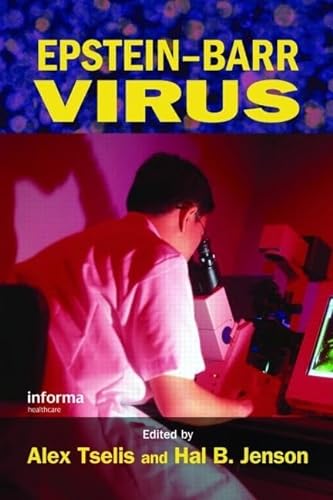 Stock image for Epstein-Barr Virus for sale by Revaluation Books