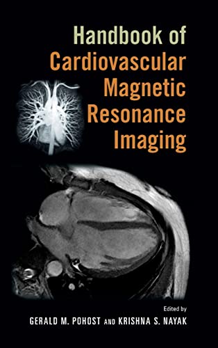 Imagen de archivo de Handbook of Cardiovascular Magnetic Resonance Imaging a la venta por HPB-Red