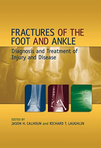 Imagen de archivo de Fractures of the Foot and Ankle: Diagnosis and Treatment of Injury and Disease a la venta por Chiron Media