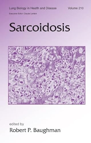 9780824759261: Sarcoidosis: 210 (Lung Biology in Health and Disease)