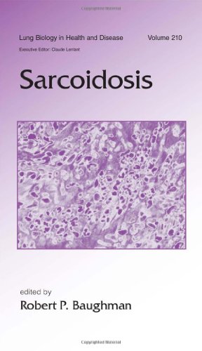 9780824759261: Sarcoidosis (Lung Biology in Health and Disease)