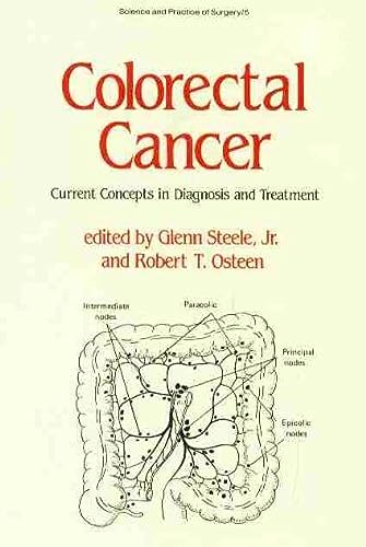 Colorectal Cancer: Current Concepts in Diagnosis and Treatment (Science and Practice of Surgery Series) (9780824773724) by Steele, Glenn