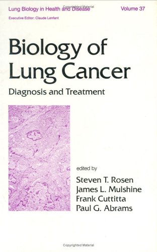 Biology of Lung Cancer (Lung Biology in Health and Disease)