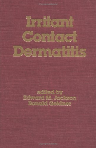 Imagen de archivo de Irritant Contact Dermatitis (Basic and Clinical Dermatology) a la venta por HPB-Red