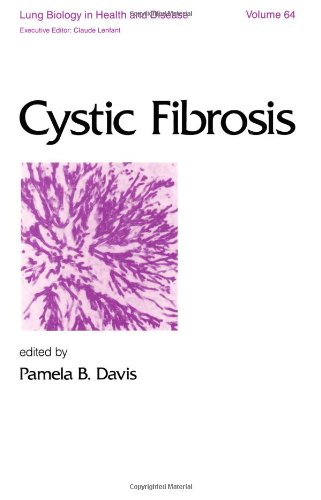 Imagen de archivo de Cystic Fibrosis (Lung Biology in Health and Disease, Volume 64) a la venta por Zubal-Books, Since 1961