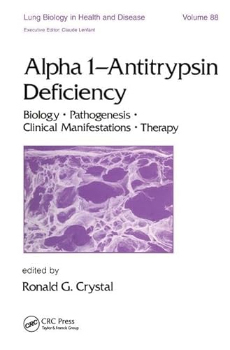 Beispielbild fr Alpha 1 - Antitrypsin Deficiency: Biology-Pathogenesis-Clinical Manifestations-Therapy (Lung Biology in Health and Disease) zum Verkauf von Mispah books