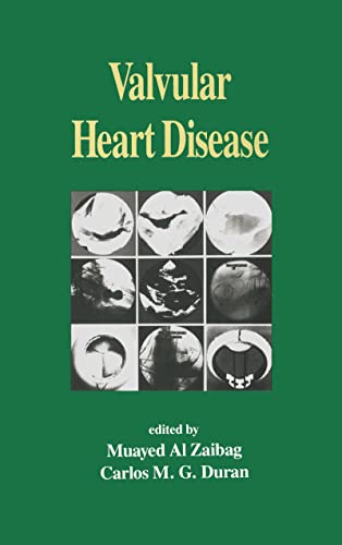 9780824788612: Valvular Heart Disease: 20 (Fundamental and Clinical Cardiology)