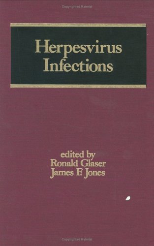 Herpesvirus Infections.