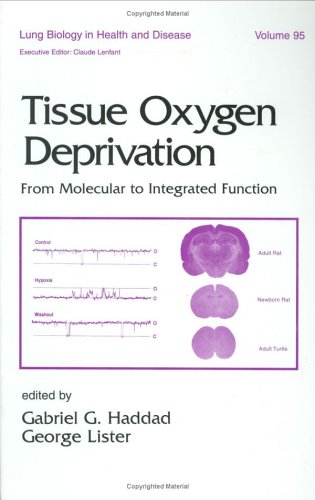 9780824794934: Tissue Oxygen Deprivation: From Molecular to Integrated Function (Lung Biology in Health and Disease)