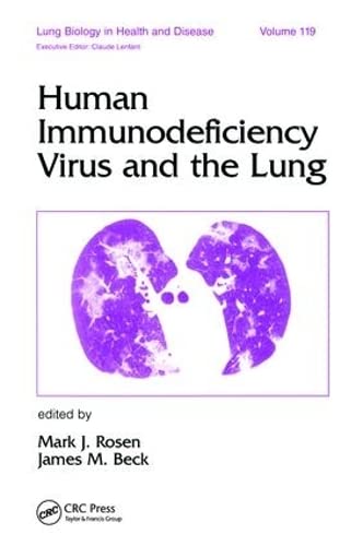 Human Immunodeficiency Virus and the Lung (Lung Biology in Health and Disease) (9780824798833) by Rosen