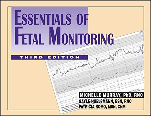 Stock image for Essentials of Fetal Monitoring for sale by Better World Books