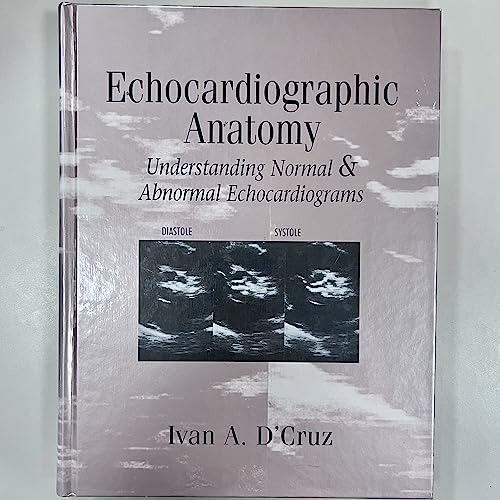 Beispielbild fr Echocardiographic Anatomy: Understanding Normal and Abnormal Echocardiograms zum Verkauf von ThriftBooks-Dallas