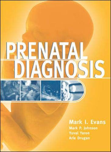 Prenatal Diagnosis (9780838576823) by Evans,Mark