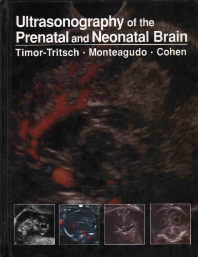 Ultrasonography of the Prenatal and Neonatal Brain